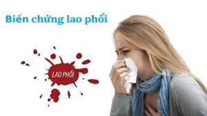 Biến chứng bệnh lao phổi