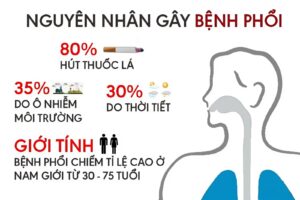 nguyên nhân gây ra bênh lao phổi