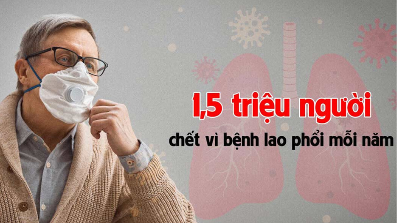 bệnh lao phổi có nguy hiểm không
