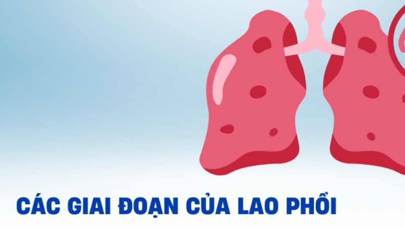 dấu hiệu bệnh lao phổi