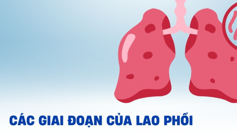 bệnh lao màng phổi sống được bao lâu